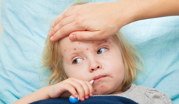 Measles Cases Surge in Caraș-Severin County in 2024